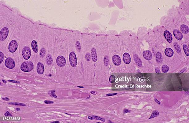 stratified columnar epithelium. duct of submandibular salivary gland, 250x shows: tall columnar cells (surface) and other cell sizes. two or more layers--surface cells columnar. - epitelio imagens e fotografias de stock