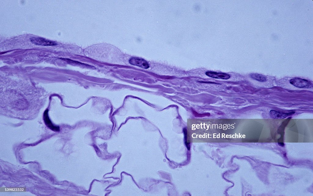 SIMPLE SQUAMOUS EPITHELIUM. (Mesothelium) Side or profile view, 250X Shows: the flatness of the squamous cells, nuclei, cytoplasm and cell membrane. Found in the human omentum
