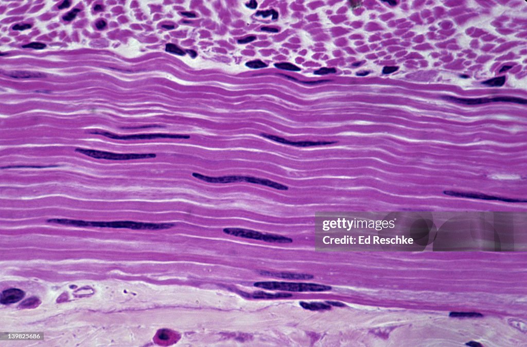 SMOOTH MUSCLE. Small Intestine (Jejunum), Circular Muscle Layer, 250X Shows: smooth muscle fibers (cells), and elongate nuclei. Nonstriated, involuntary muscle.