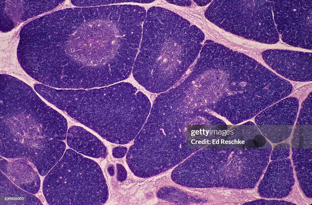 THYMUS. 10X Shows: numerous lobules, cortex (darker with numerous lymphocytes), medulla (lighter). Produces a hormone thymosin.