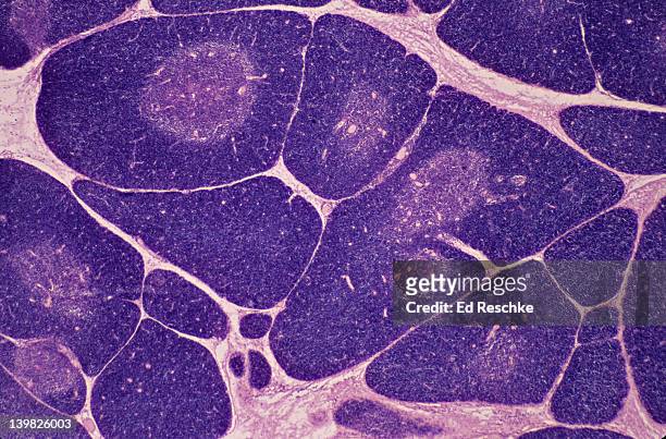 thymus. 10x shows: numerous lobules, cortex (darker with numerous lymphocytes), medulla (lighter). produces a hormone thymosin. - biological cell stock pictures, royalty-free photos & images