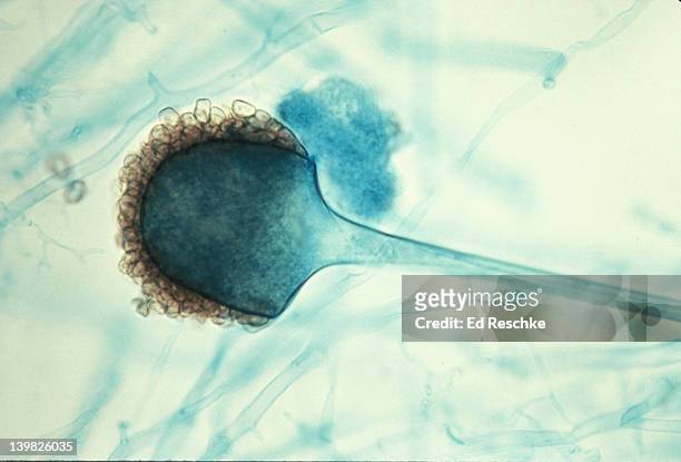 rhizopus (bread mold). sporanquim and spores. asexual reproduction. 100x - microphotographie immunofluorescente photos et images de collection