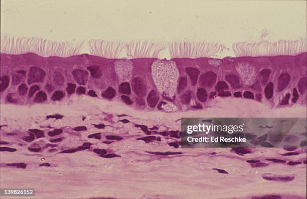 photomicrograph of pseudostratified ciliated columnar epithelium of the trachea with goblet cells; 100x. - menselijke luchtpijp stockfoto's en -beelden