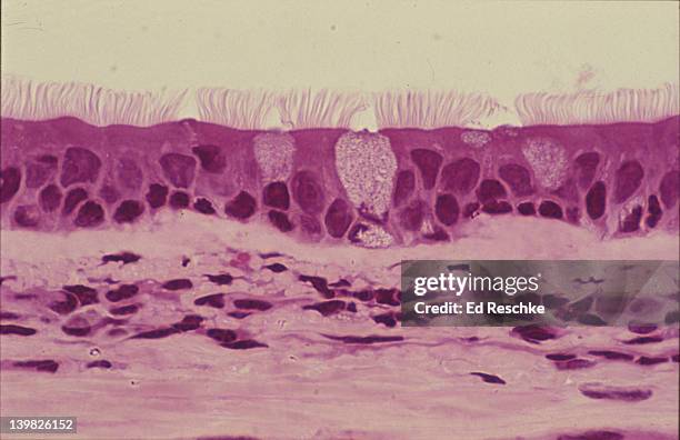 photomicrograph of pseudostratified ciliated columnar epithelium of the trachea with goblet cells; 100x. - epitelio imagens e fotografias de stock
