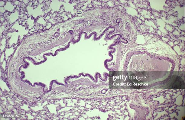 photomicrograph of bronchiole and blood vessel with surrounding alveoli; epithelium and smooth muscle visible in bronchiole. - lungenbläschen stock-fotos und bilder