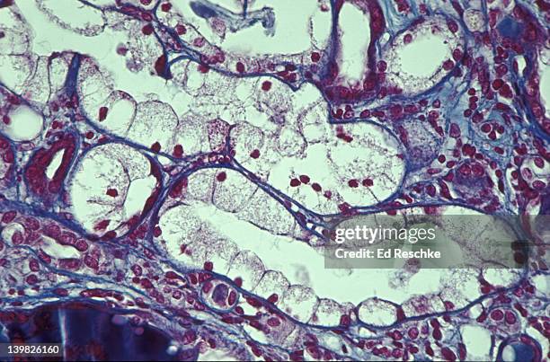 photomicrograph of simple cuboidal epithelium from kidney tubules; 100x. - cuboidal epithelium stock pictures, royalty-free photos & images