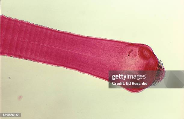 photomicrograph of tapeworm ( taenia pisiformis) showing scolex (head suckers and hooks) and proglottids (segments) formed below neck; 10x. - tapeworm stockfoto's en -beelden