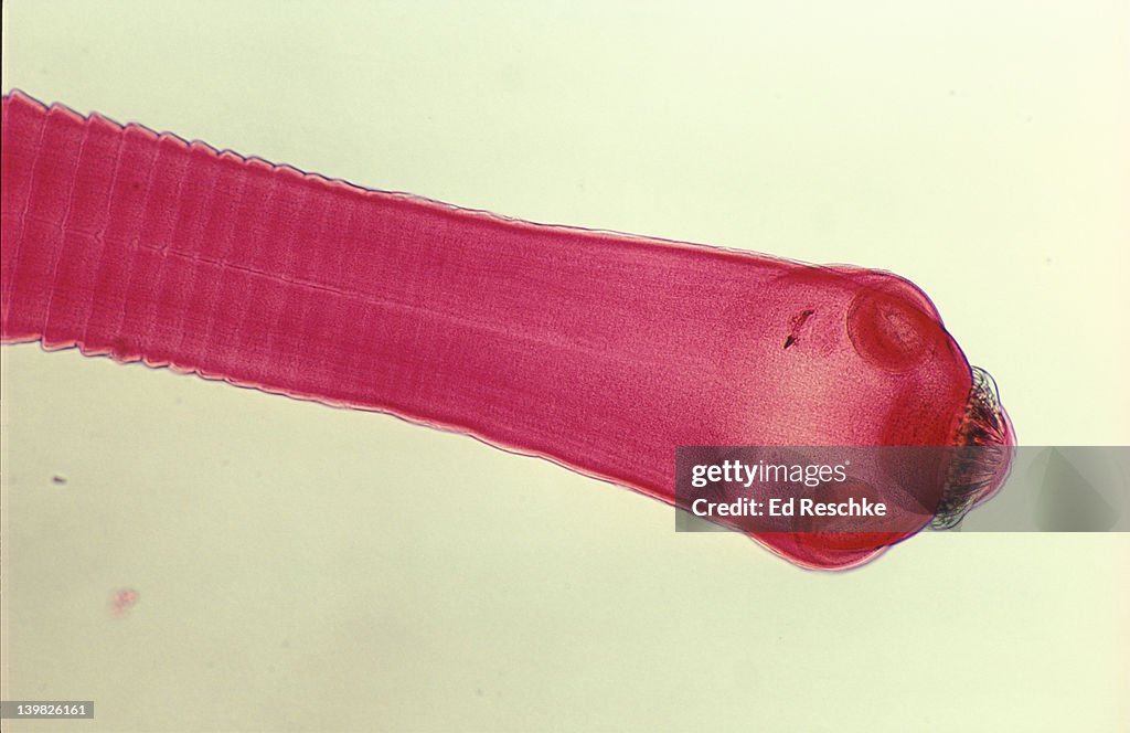 Photomicrograph of tapeworm ( Taenia pisiformis) showing scolex (head suckers and hooks) and proglottids (segments) formed below neck; 10X.