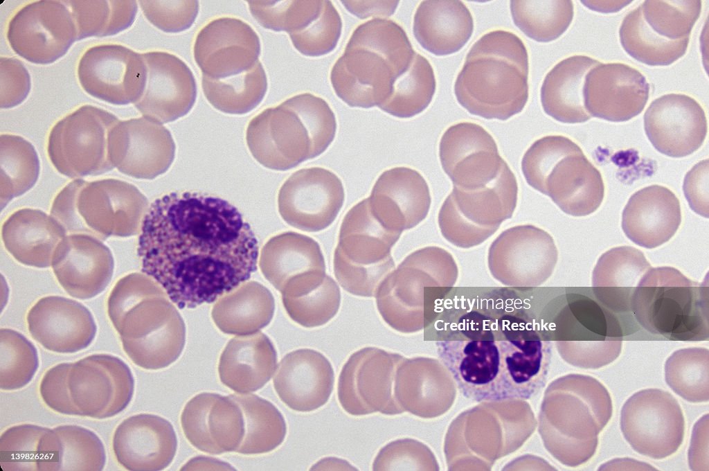 Blood 400x Red Blood Cells The Central Pallor Of The Rbcs Relates To