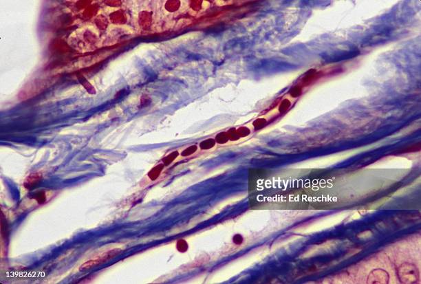 capillary with red blood cells. in single file, also shows endothelium (center). human scalp. 200x h - endothelial stock pictures, royalty-free photos & images