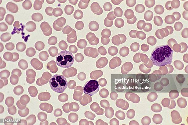 human blood smear; red blood cells, platelets and white blood cells, neutrophils, lymphocytes, monocyte, 250x - platelet stock-fotos und bilder