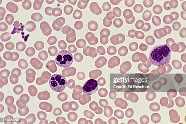 human blood smear; red blood cells, platelets and white blood cells, neutrophils, lymphocytes, monocyte, 250x - white blood cells stockfoto's en -beelden