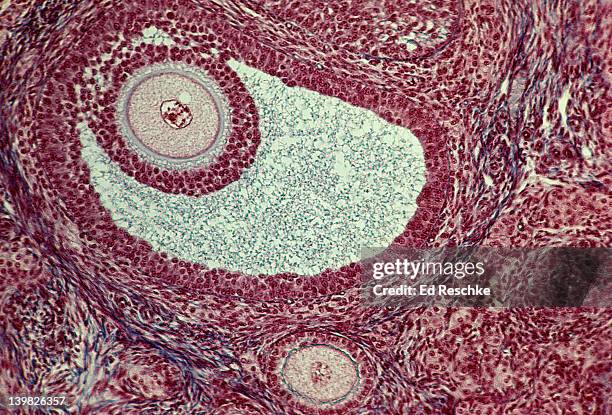 graafian follicle and primary follicle. ovary. oocyte (eeg), atnrum, 50x. h - human egg stockfoto's en -beelden