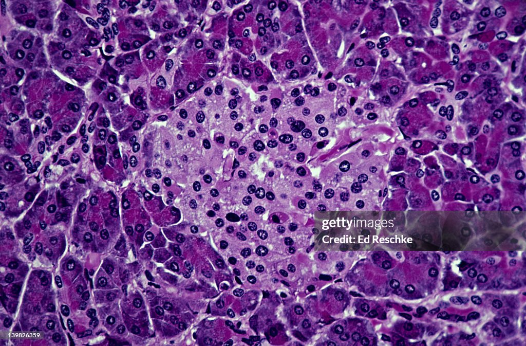 ISLET OF LANGERHANS, PANCREAS, 100X. Shows: endocrine tissue (light, pink tissue) consisting of islet cells (alpha and beta cells), and exocrine tissue (surrounding, dark tissue). Beta cells secrete insuline and the alpha cells secrete glucagon.