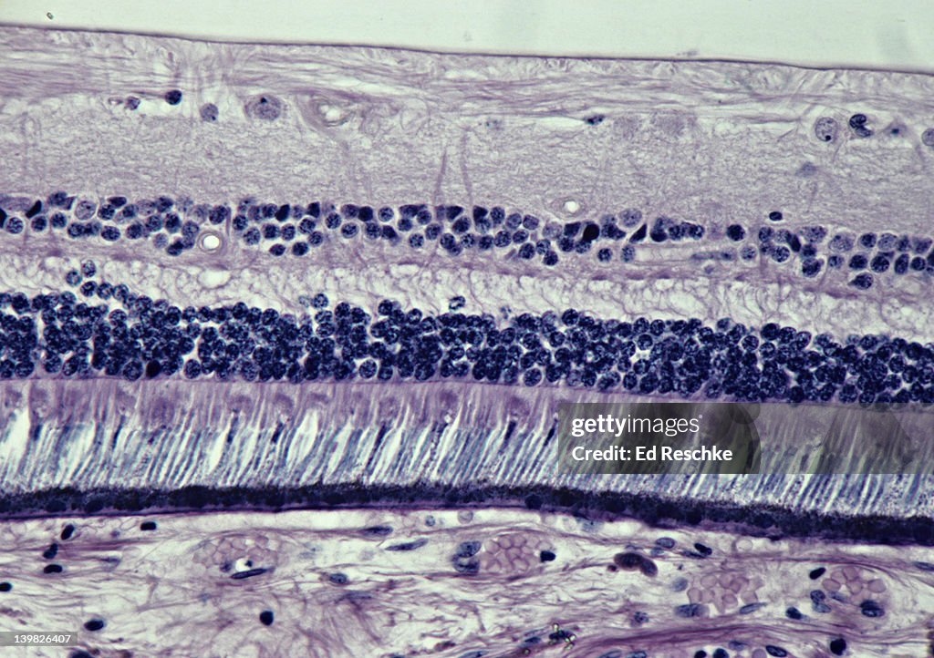 RETINA, 100X Shows: Photoreceptor cells (rods and cones), bipolar neurons, ganglion cells, nerve fibers, choroid coat, and sclera. (SI) SIMILAR to 13934