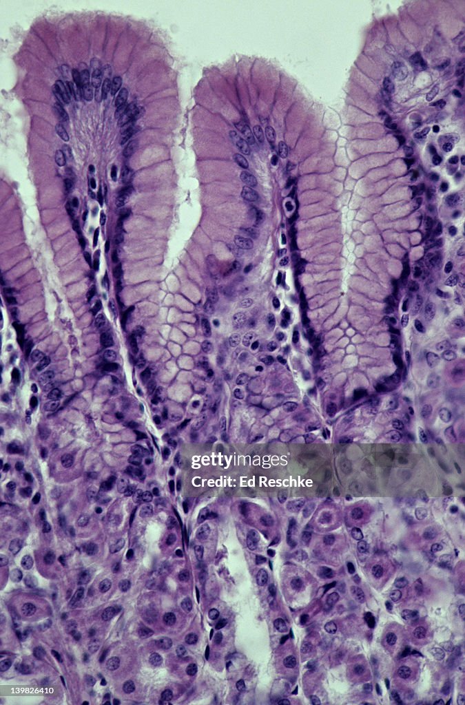 STOMACH MUCOSA. FUNDIC REGION WITH GASTRIC GLANDS, HUMAN, 100X Shows: simple columnar epithelium, gastric pits, gastric glands with parietal (secrete HCl) and chief cells (secrete enzymes).