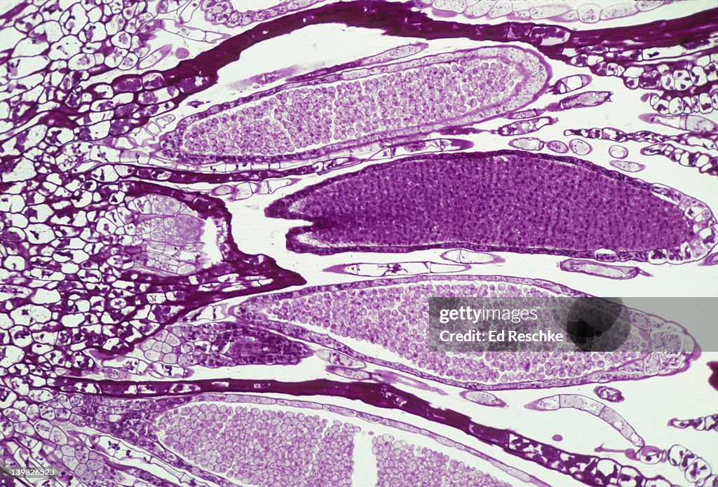 MOSS - ANTHERIDIA AND SPERM. 50X
