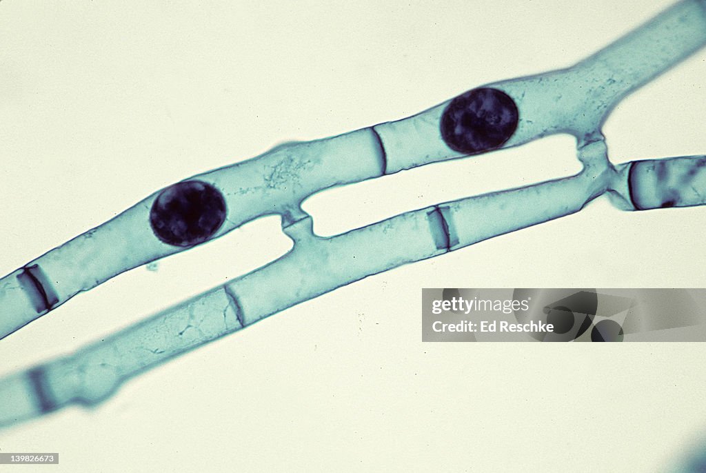 SPIROGYRA, CONJUGATION, SHOWS 2 ZYGOTES (ZYGOSPORES) AND CONJUGATION TUBES 400X