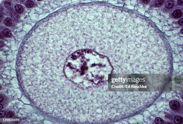 oocyte (egg) from mature ovarian follicle. shows: nucleus, cytoplasm, zona pellucida. 250x - citoplasma imagens e fotografias de stock
