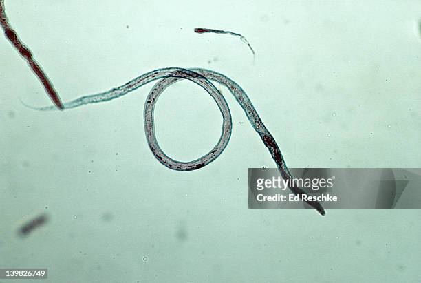 nematode - vinegar eel. turbatrix aceti. phylum aschelminthes. 50x - acetobacter bacteria fotografías e imágenes de stock