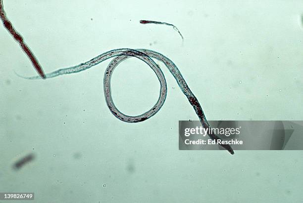 nematode - vinegar eel. turbatrix aceti. phylum aschelminthes. 50x - anguillula dell'aceto foto e immagini stock