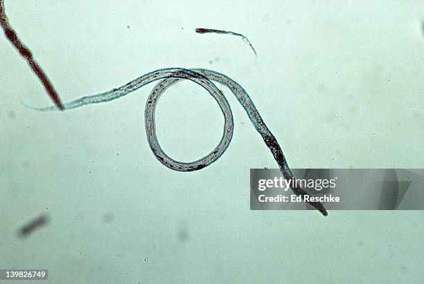 nematode - vinegar eel. turbatrix aceti. phylum aschelminthes. 50x - nematode worm bildbanksfoton och bilder