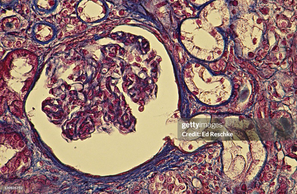KIDNEY -- NEPHRON, GLOMERULUS, BOWMAN S CAPSULE, PROXIMAL CONVOLUTED TUBULE, 100X Shows: Glomerulus, Bowman s (or Glomerular) Capsule, Proximal convoluted tubule, other tubules. Human.