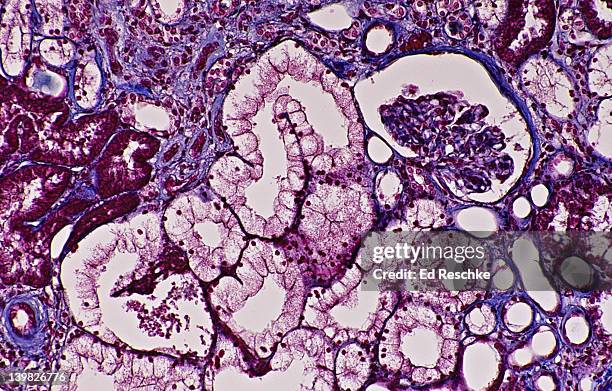 kidney --- nephron, glomerulus, bowman s capsule, kidney tubules, 50x. human. shows: glomerulus, bowman s capsule, renal tubules (proximal, distal & loop of henle) mallory stain. - malloryfärgning bildbanksfoton och bilder