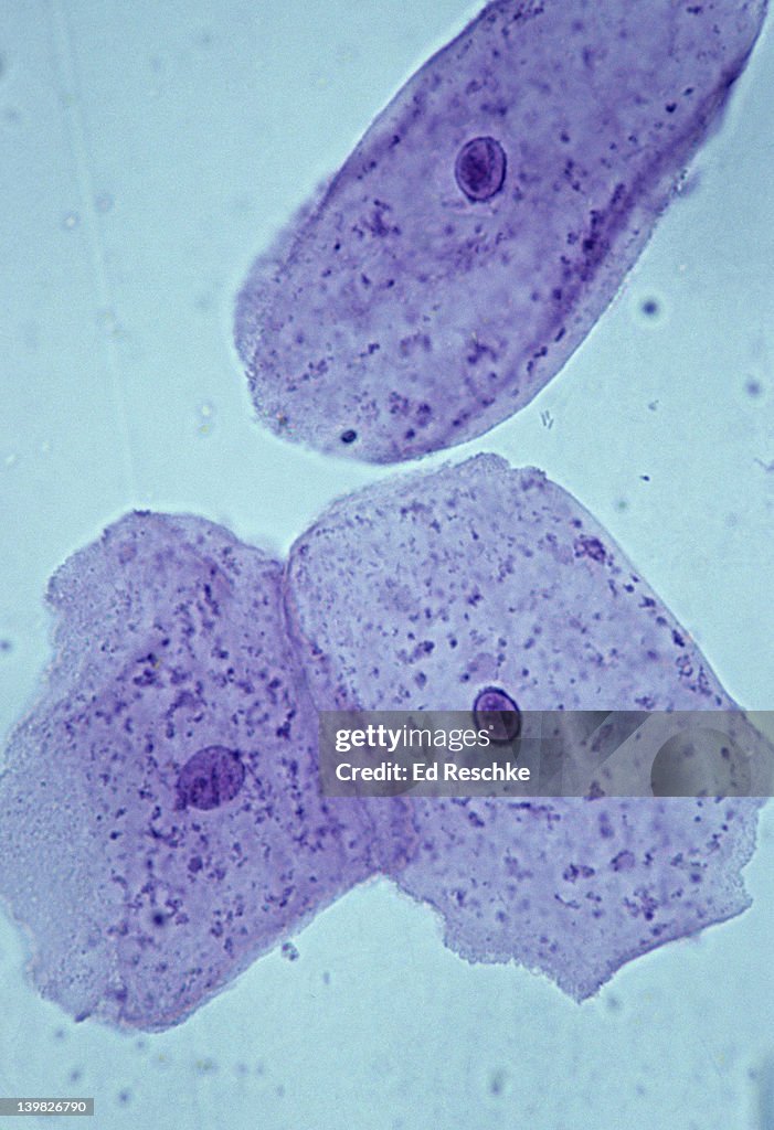 CHEEK CELLS. SQUAMOUS EPITHELIAL CELLS, human, oral cavity, 250x. Shows: nucleus, cytoplasm and cell membrane. Obtained by lightly scraping the inside of the oral cavity.