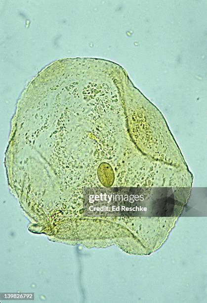 cheek cell. human squamous epithelial cell, mouth, 250x. shows: nucleus, cytoplastm and cell membrane. this is a very flat (or squamous) cell obtained inside the oral cavity. iodine stain. - light micrograph stock-fotos und bilder