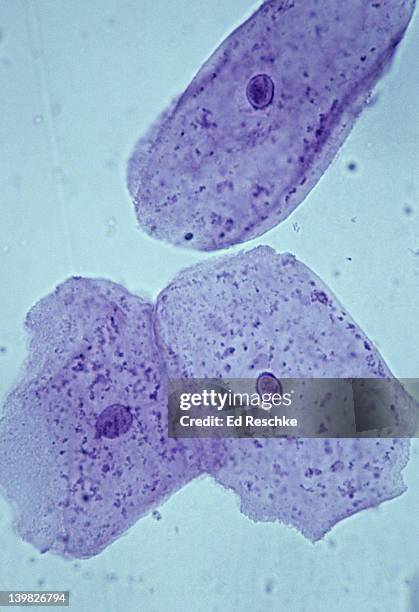 cheek cells. squamous epithelial cells, human, oral cavity, 250x. shows: nucleus, cytoplasm and cell membrane. obtained by lightly scraping the inside of the oral cavity. - citoplasma imagens e fotografias de stock