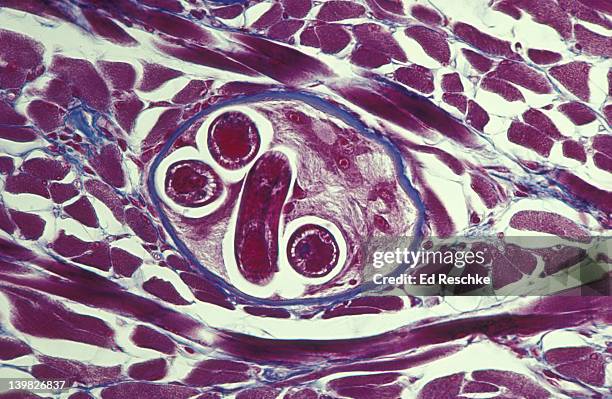 photomicrograph of trichinella spiralis; trichina worm encysted in muscle; 100x. - nematode worm stockfoto's en -beelden