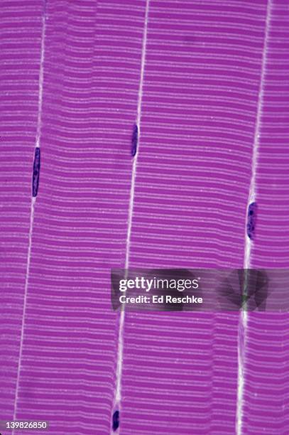 Multinucleated Tissue Multinucleate Photos and Premium High Res Pictures - Getty Images