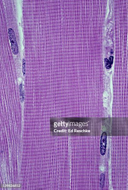 skeletal muscle fiber (cell) in center. longitudinal section, 250x at 35mm. shows: striations, multinucleate nature of muscle, myofibrils (longitudinally arranged thread-like structures), & endomysium (loose connective tissue between fibers). - skeletal muscle stock pictures, royalty-free photos & images