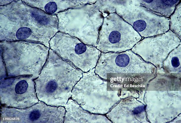 simple squamous epithelium. mesothelium, surface view, 250x. shows: simple squamous cells connected (sometimes called pavement epithelium), nuclei, cytoplasm, and cell membranes. found in the mesentery. - epitélio escamoso imagens e fotografias de stock