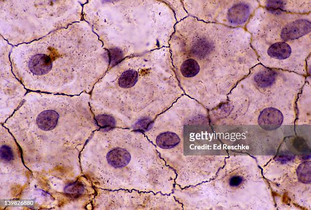 simple squamous epithelium, (mesothelium) surface view, 250x. shows: shows squamous cells connected (sometimes called pavement epithelium), nuclei, cytoplasm, cell membrane. this epithelium is found in the mesentery. - epitélio escamoso imagens e fotografias de stock