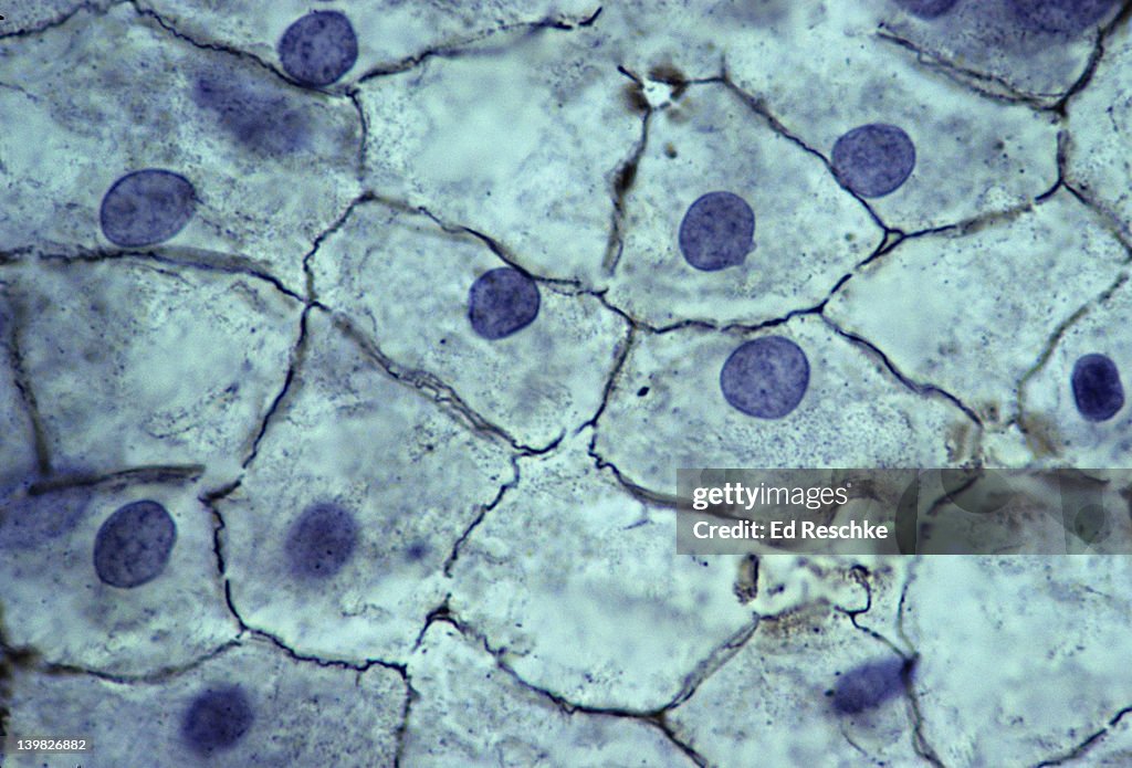 SIMPLE SQUAMOUS EPITHELIUM. Mesothelium, surface view, 250X. Shows: simple squamous cells connected (sometimes called pavement epithelium), nuclei, cytoplasm, and cell membranes. Found in the mesentery.