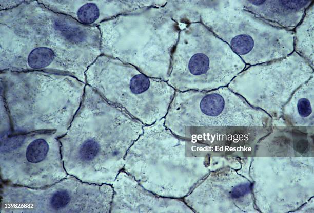 simple squamous epithelium. mesothelium, surface view, 250x. shows: simple squamous cells connected (sometimes called pavement epithelium), nuclei, cytoplasm, and cell membranes. found in the mesentery. - epitélio escamoso imagens e fotografias de stock