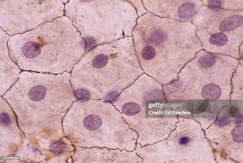 SIMPLE SQUAMOUS EPITHELIUM. (Mesothelium) Surface View, 250X Shows: shows squamous cells connected (sometimes called pavement epithelium), nuclei, cytoplasm, cell membrane. This epithelium is found in the mesentery.