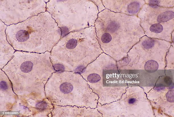 simple squamous epithelium. (mesothelium) surface view, 250x shows: shows squamous cells connected (sometimes called pavement epithelium), nuclei, cytoplasm, cell membrane. this epithelium is found in the mesentery. - epitelio squamoso foto e immagini stock