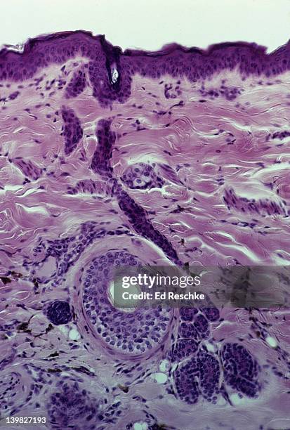 sweat gland & duct on human scalp leading to surface. cross-section of a follicle, epidermis, dermis - sweat gland stock pictures, royalty-free photos & images