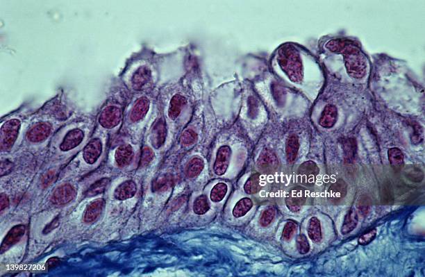 transitional epithelium, ureter, 250x. shows: cell layers, cells near surface, larger & pear-shaped, basement membrane, & supporting connective tissue below. unstretched state, these cells can flatten out when ureter is stretched. mallory stain. - mallory stain stock pictures, royalty-free photos & images