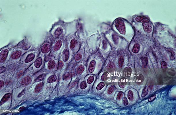 transitional epithelium, ureter, 250x. shows: cell layers, cells near surface, larger & pear-shaped, basement membrane, & supporting connective tissue below. unstretched state, these cells can flatten out when ureter is stretched. mallory stain. - transitional epithelium stock pictures, royalty-free photos & images