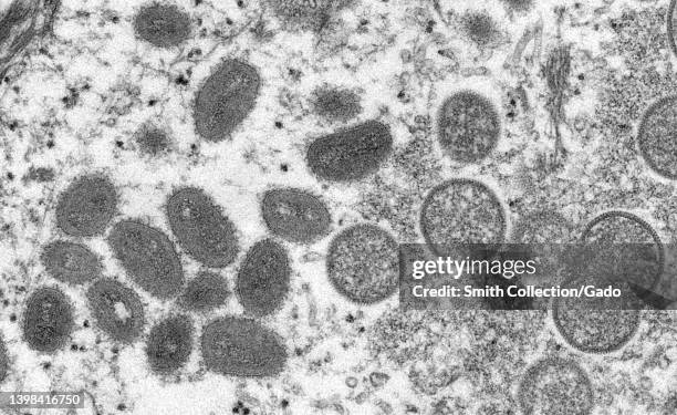 Electron microscope image of various virions of the monkeypox virus taken from human skin, 2003. Courtesy CDC/Goldsmith.