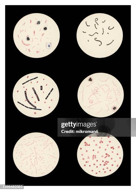 old chromolithograph illustration of magnification of bacteria - micrococcus stock-fotos und bilder