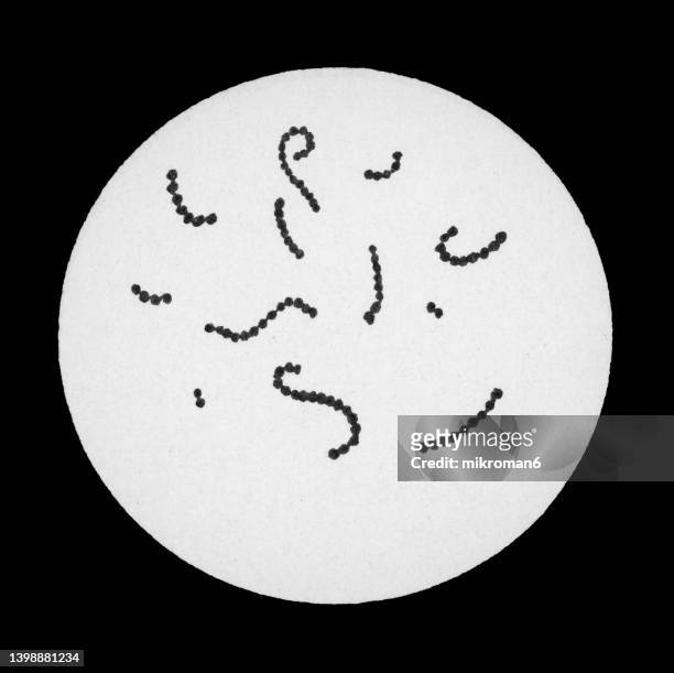 old chromolithograph illustration of magnification of bacteria streptococcus pyogens - anthrax stock pictures, royalty-free photos & images