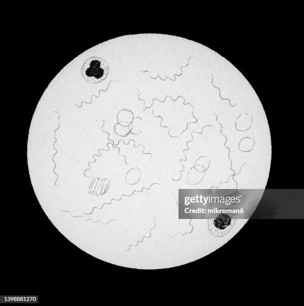 old chromolithograph illustration of magnification of bacteria borrelia recurrentis - spiral bacterium stock pictures, royalty-free photos & images