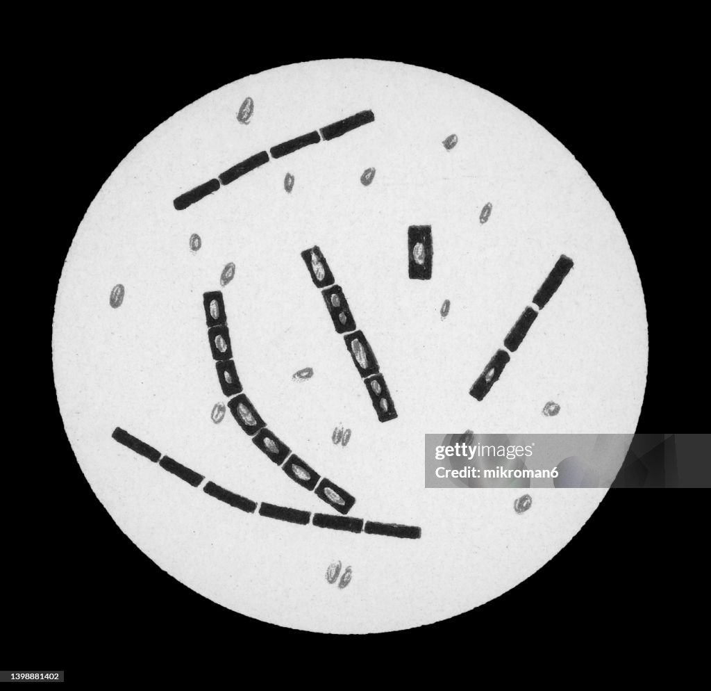 Old chromolithograph illustration of magnification of bacteria Bacillus anthracis