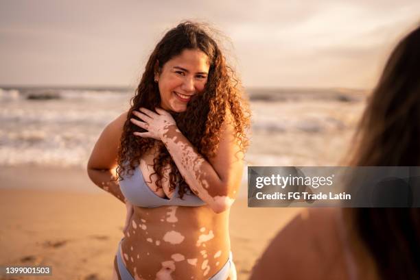 porträt einer jungen frau am strand - vitiligo stock-fotos und bilder