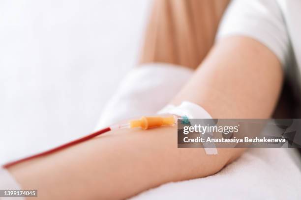 hand with an infusion system through which blood flows - blutspende stock-fotos und bilder